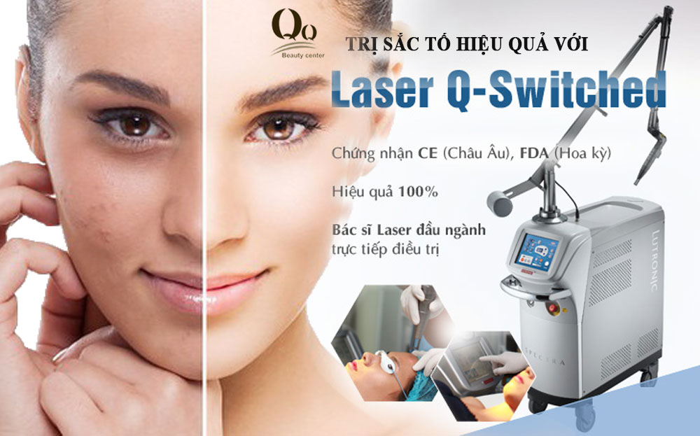 Công nghệ Laser điều trị sắc t